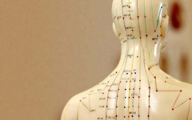 electroacupunture